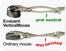 evoluent verticalmouse 4 small wireless